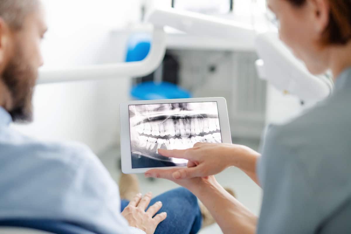 Duración de los implantes dentales... ¿son para toda la vida?