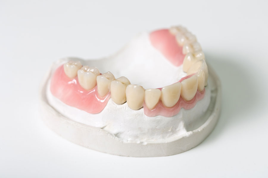Prótesis dental sobre modelo de dientes