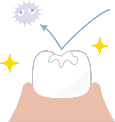 sellador-vidrio-ionomero